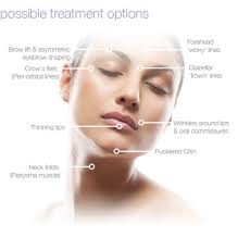 Diagram of a face labeling possible facial rejuvenation treatments